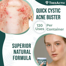 Load image into Gallery viewer, TreeActiv Cystic Acne Spot Treatment, Hormonal Acne Treatment &amp; Overnight Sulfur Cystic Acne Treatment For Face, Pimples, and Blemishes for Adults, Men, and Women - 0.5oz 120+ Uses