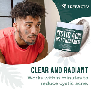 TreeActiv Cystic Acne Spot Treatment, Hormonal Acne Treatment & Overnight Sulfur Cystic Acne Treatment For Face, Pimples, and Blemishes for Adults, Men, and Women - 0.5oz 120+ Uses